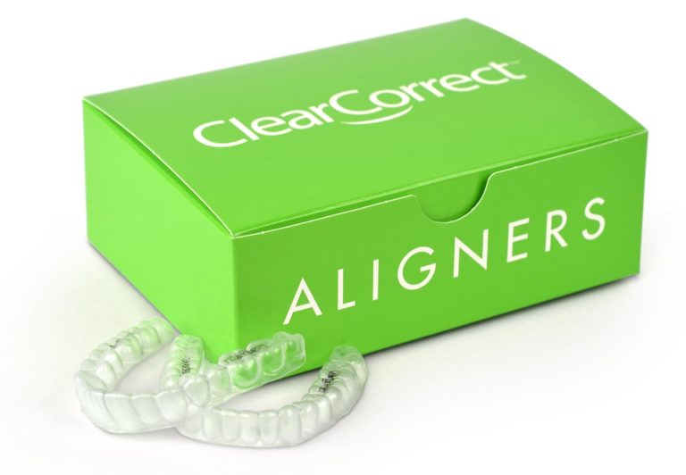 Clear Aligners in Townsville