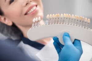 Are Porcelain Veneers Permanent? - Deeragun Dental
