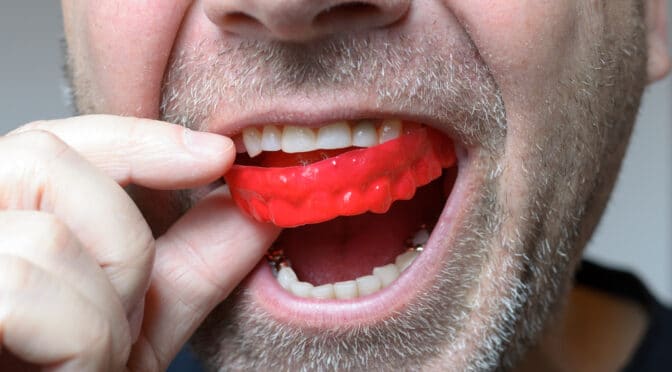 Which Mouthguard is best for me? | Best Mouthguard for Adults