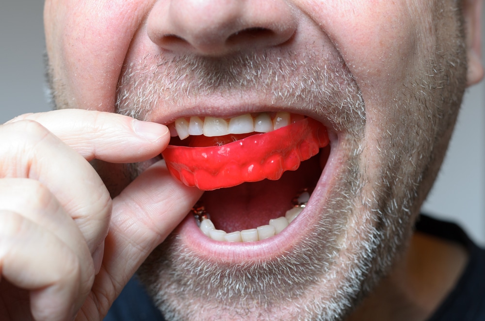 mouthguard for Adults