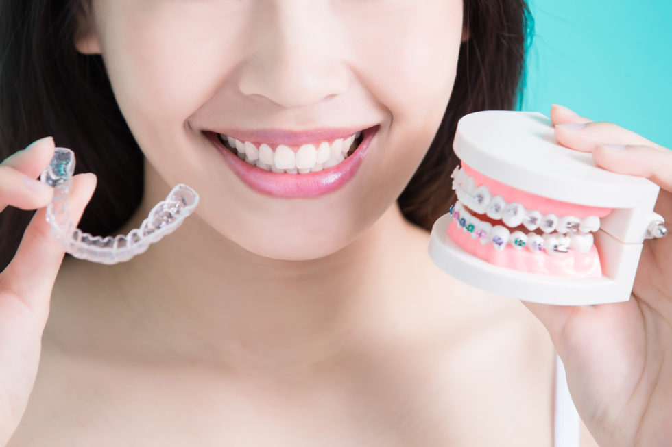 Are clear aligners better than braces?