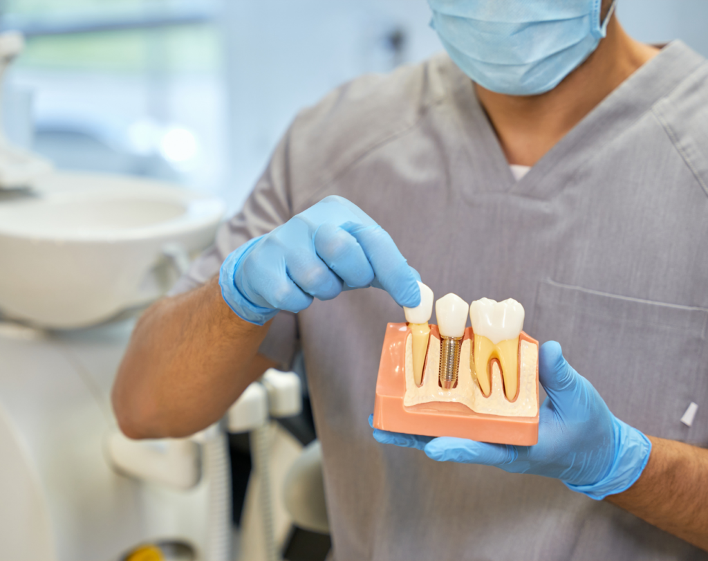dental implants in Townsville