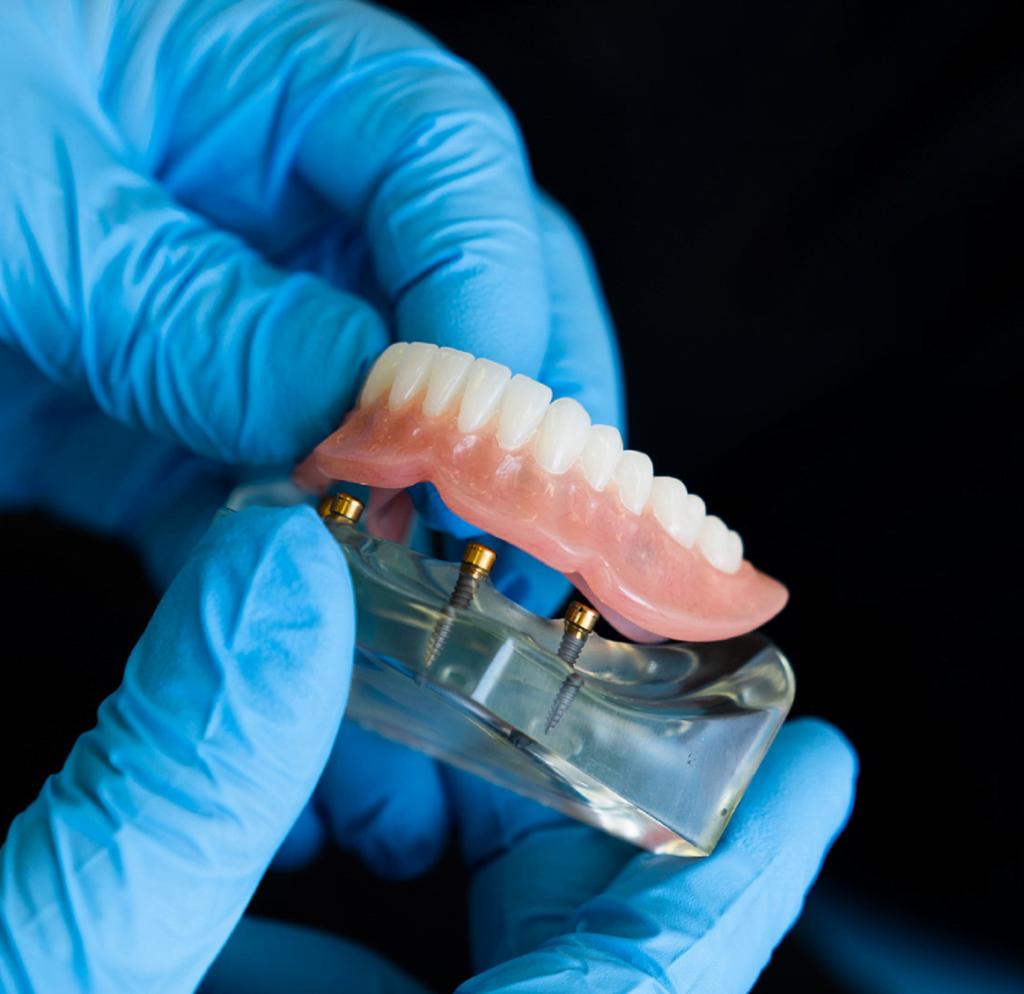 Denture in Deegragun