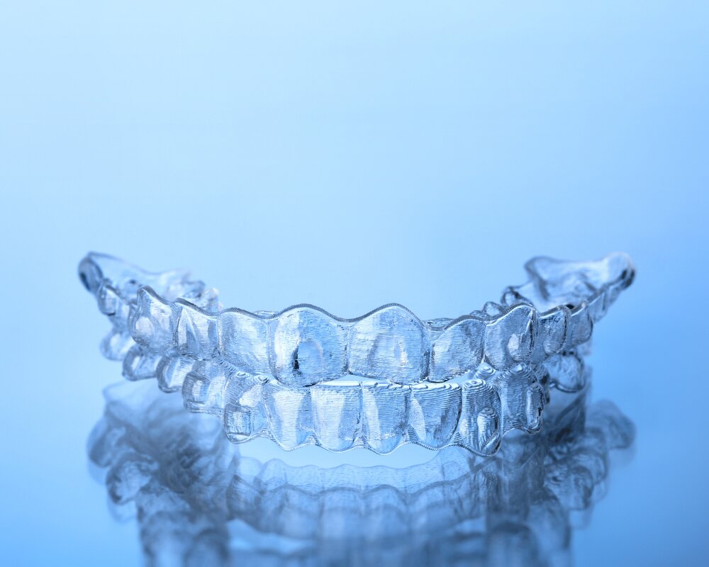 clear aligner in Townsville