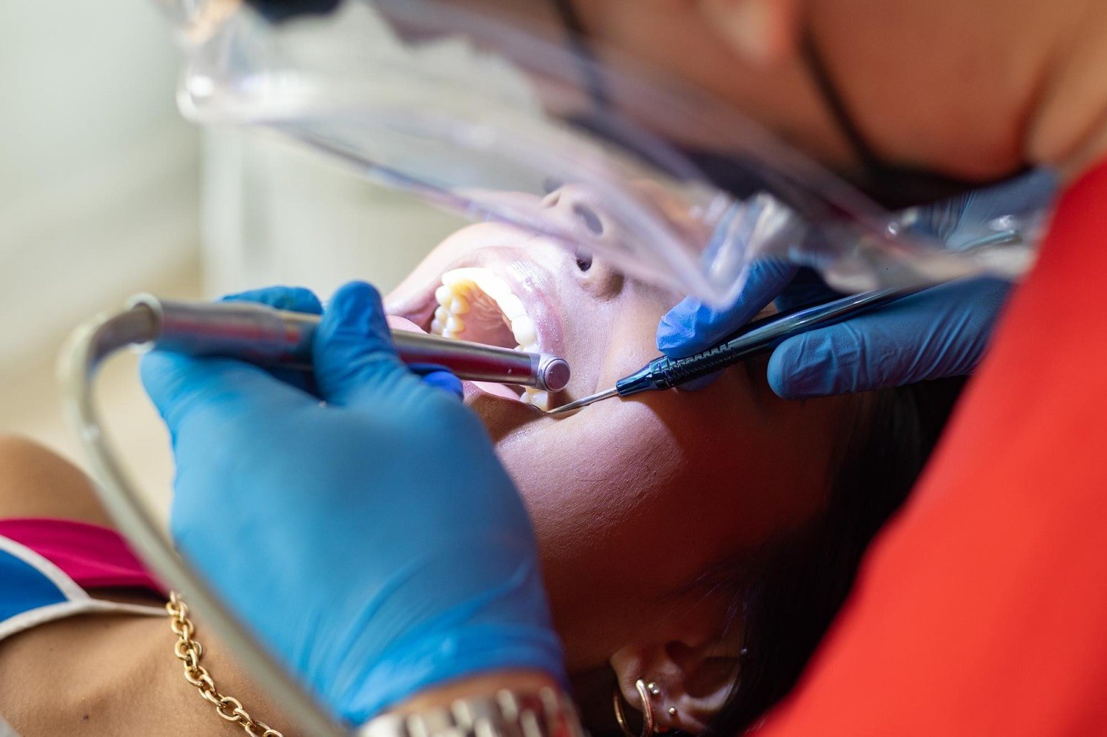 wisdom tooth extraction procedure